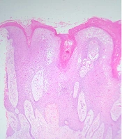 J Skin Stem Cell